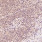 Anti-GRP78 BiP HSPA5 Rabbit Monoclonal Antibody